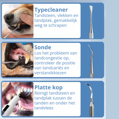 Elektrische Tandsteen Verwijderaar Set